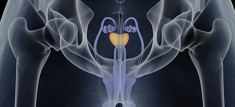 Опыт лечения рака предстательной железы при помощи криоаблации