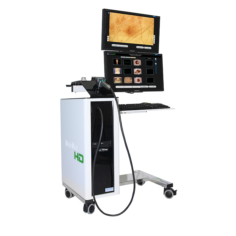 Видеодерматоскоп MoleMax HD Derma Medical Systems-1
