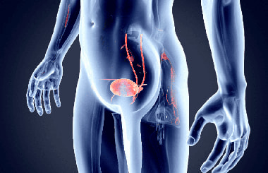 Гипертермическая химиотерапия с использованием митомицина-C