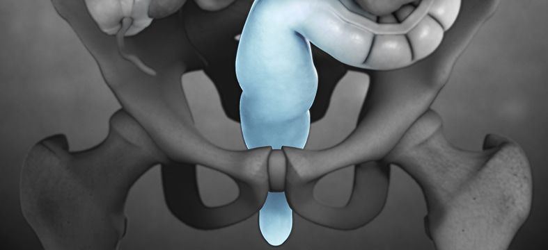 Использование инновационных методов 3D УЗИ для визуализации аноректальных состояний