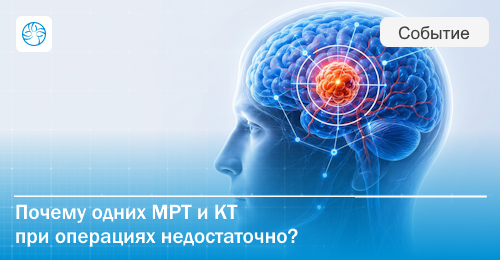Зачем нейронавигация при операциях на опухолях головного мозга?