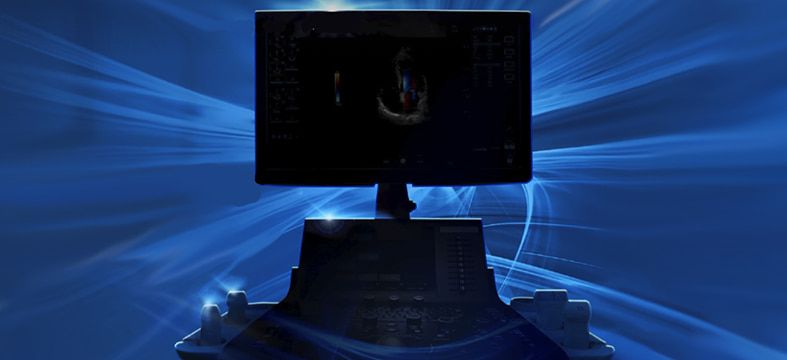 Презентация новой ультразвуковой системы GE